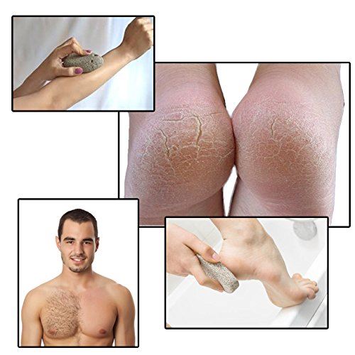 Skinapeel Pumice Stone