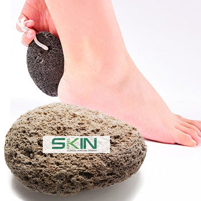 Skinapeel Pumice Stone